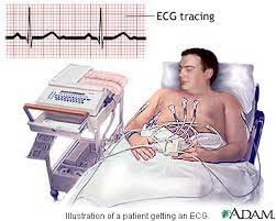 Person receiving an EKG, a life-saving preventative cardiology benefit