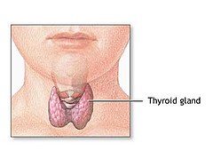 llustration of the thyroid gland in the neck area, highlighting the dangers associated with untreated hyperthyroidism.